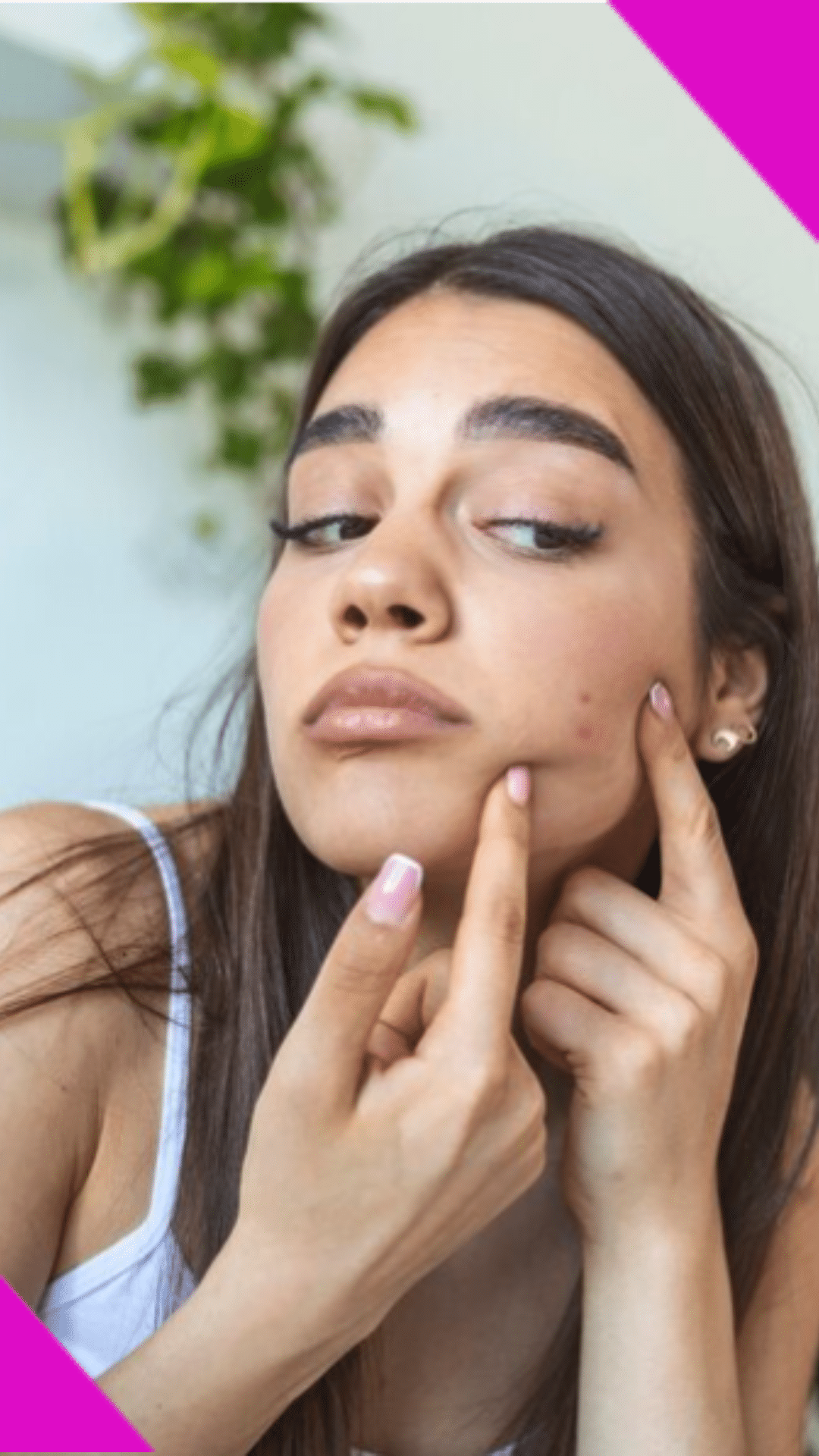 skin-care-tips-home-remedies-for-acne-scars-trends9