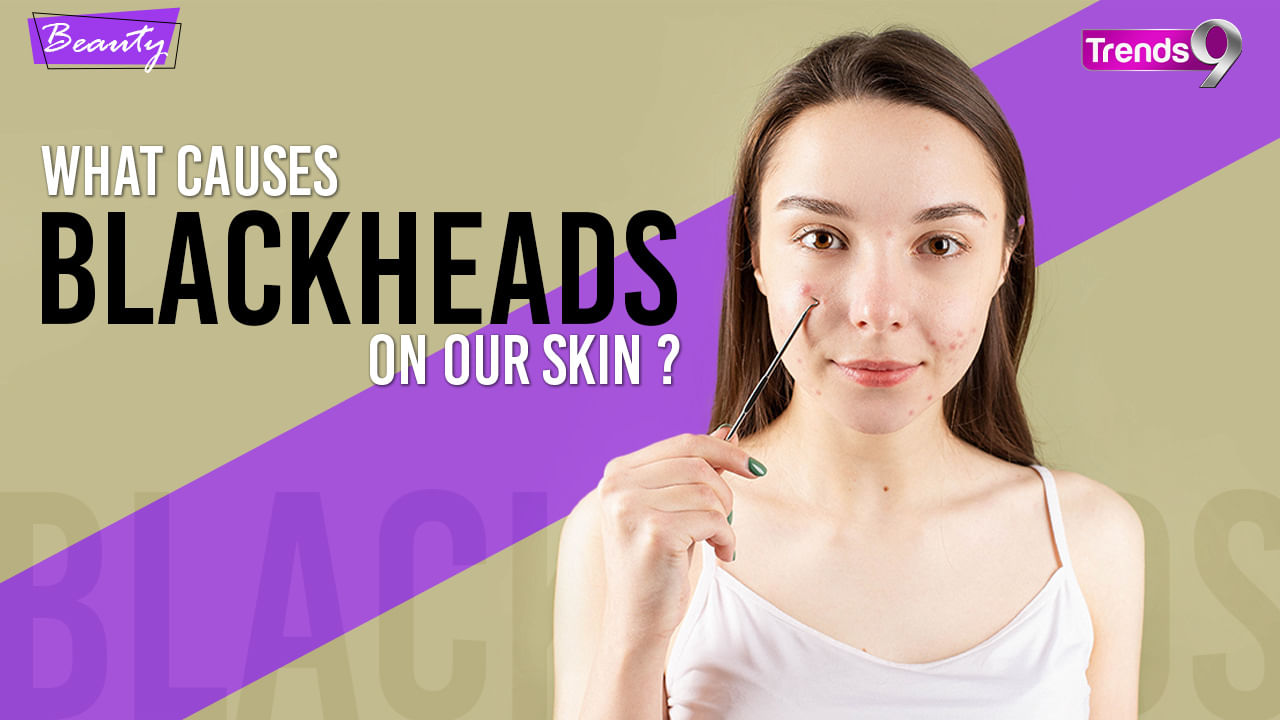 How To Get Rid Of Blackheads ? Blackhead Removal Treatment Watch Video